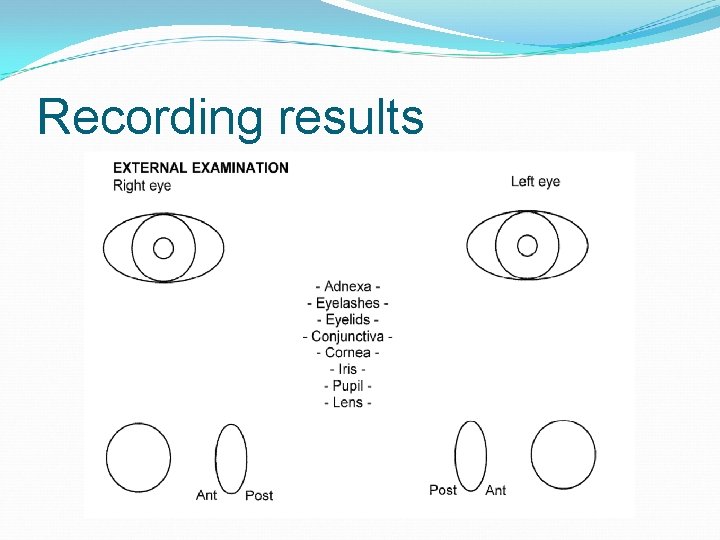 Recording results 