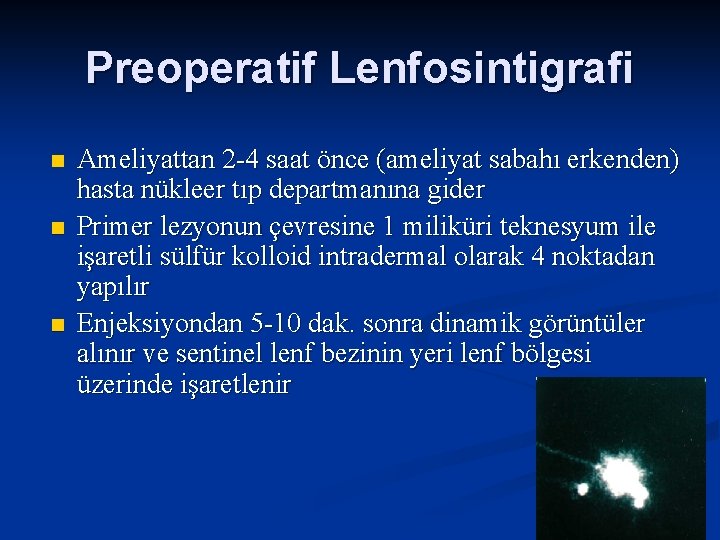 Preoperatif Lenfosintigrafi n n n Ameliyattan 2 -4 saat önce (ameliyat sabahı erkenden) hasta