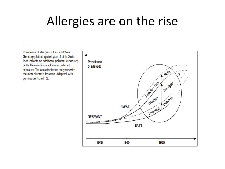 Allergies are on the rise 