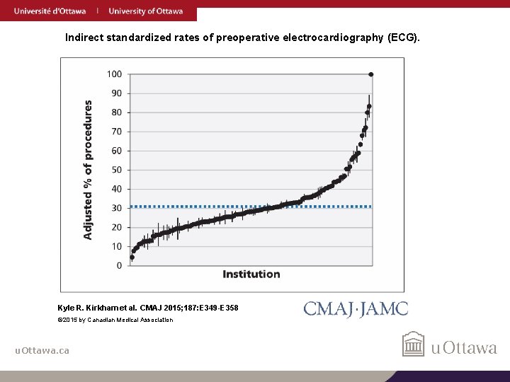 Indirect standardized rates of preoperative electrocardiography (ECG). Kyle R. Kirkham et al. CMAJ 2015;