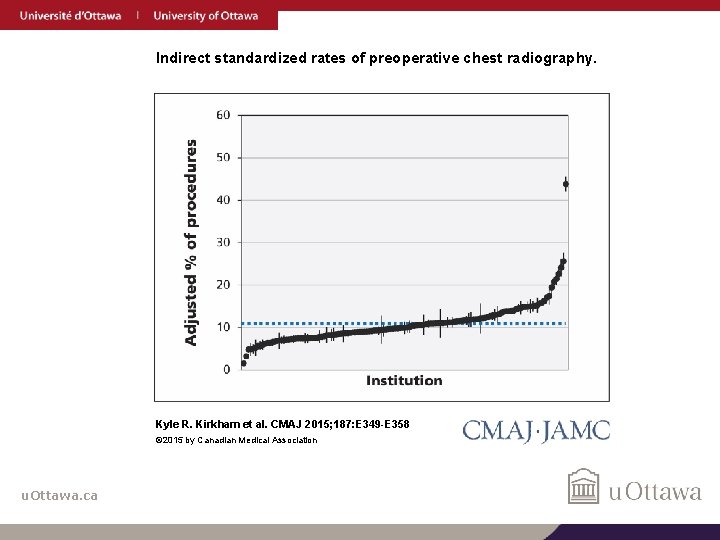 Indirect standardized rates of preoperative chest radiography. Kyle R. Kirkham et al. CMAJ 2015;