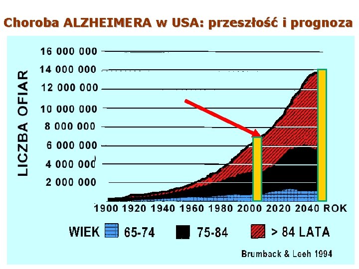 Choroba ALZHEIMERA w USA: przeszłość i prognoza 