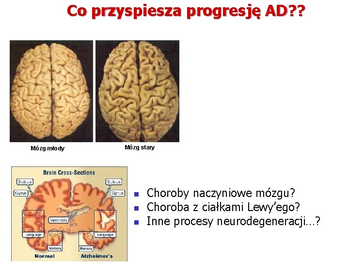 Co przyspiesza progresję AD? ? Mózg młody Mózg stary n n n Choroby naczyniowe