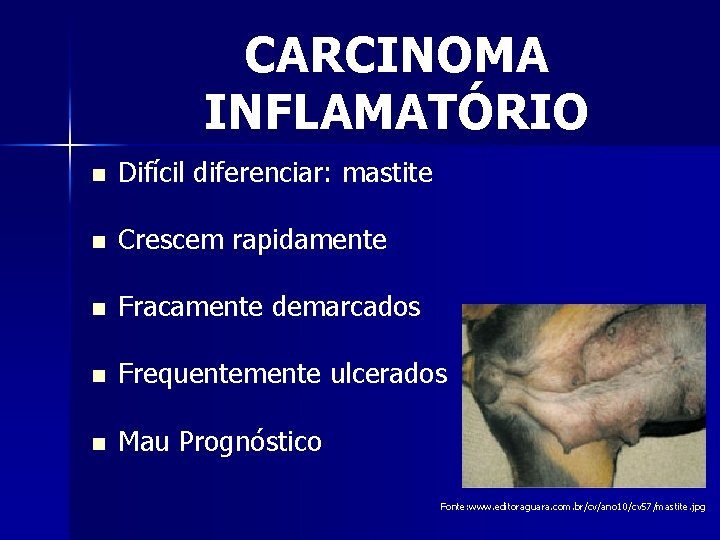 CARCINOMA INFLAMATÓRIO n Difícil diferenciar: mastite n Crescem rapidamente n Fracamente demarcados n Frequentemente