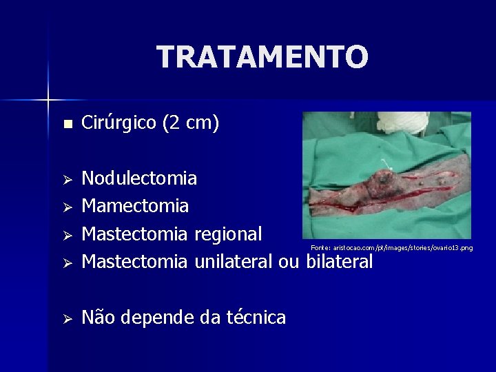 TRATAMENTO n Cirúrgico (2 cm) Ø Ø Nodulectomia Mamectomia Mastectomia regional Mastectomia unilateral ou