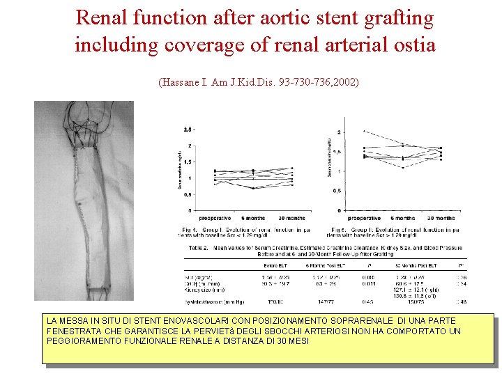 Renal function after aortic stent grafting including coverage of renal arterial ostia (Hassane I.