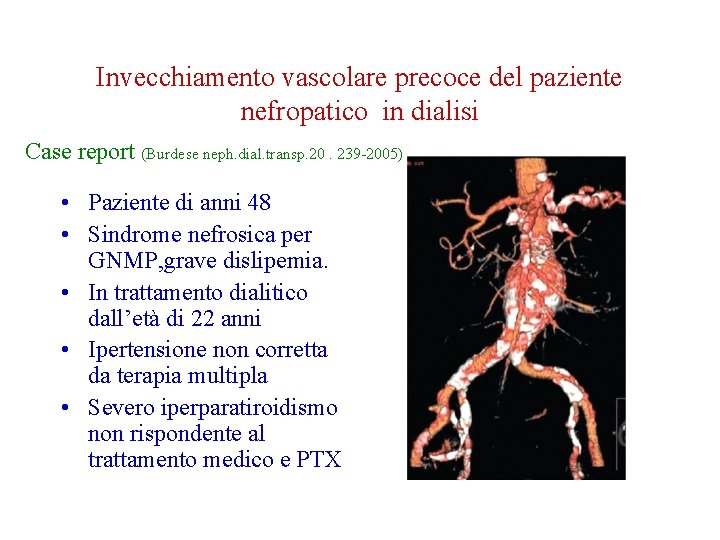 Invecchiamento vascolare precoce del paziente nefropatico in dialisi Case report (Burdese neph. dial. transp.