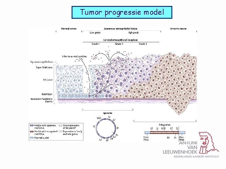 Tumor progressie model 