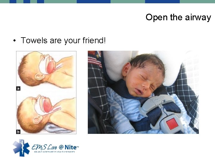Open the airway • Towels are your friend! 