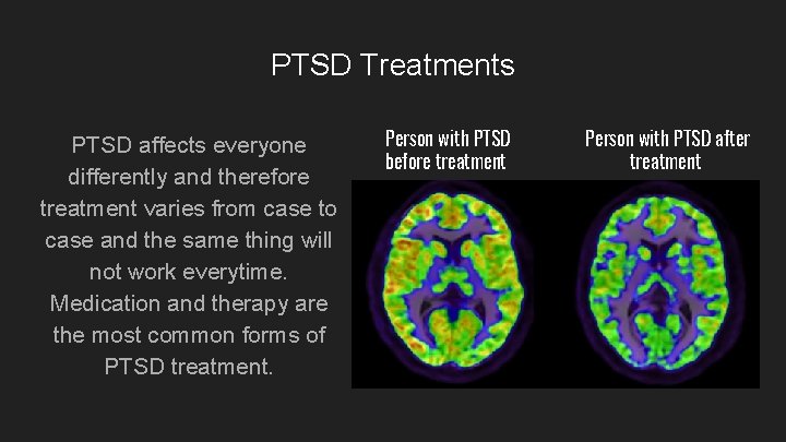 PTSD Treatments PTSD affects everyone differently and therefore treatment varies from case to case