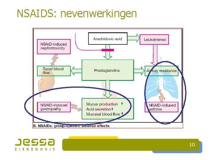 NSAIDS: nevenwerkingen 10 