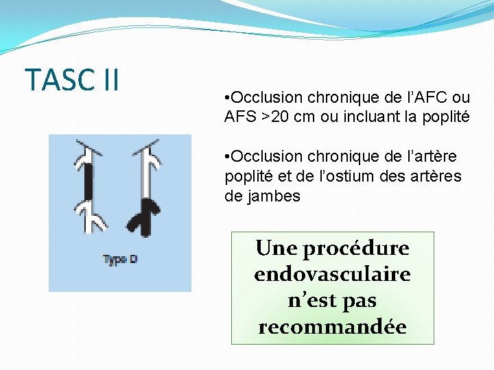 TASC II • Occlusion chronique de l’AFC ou AFS >20 cm ou incluant la