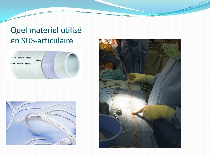 Quel matèriel utilisé en SUS-articulaire 