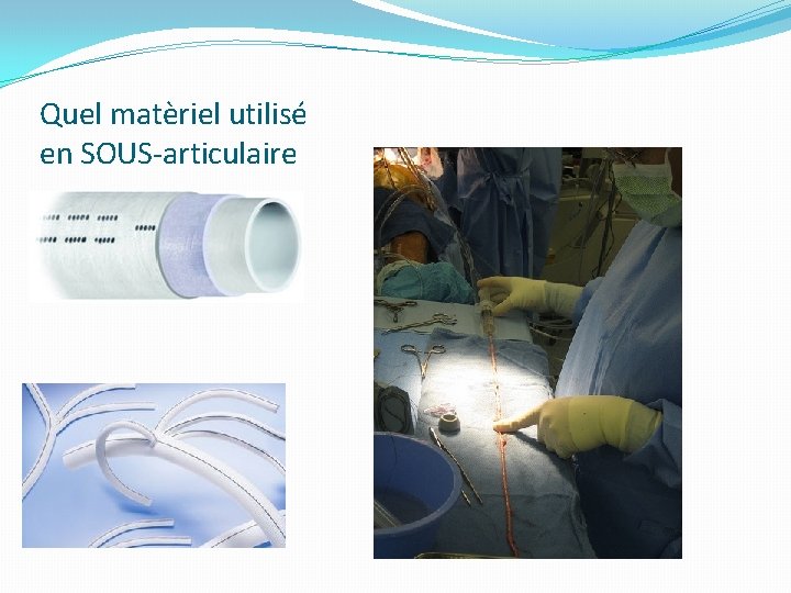 Quel matèriel utilisé en SOUS-articulaire 
