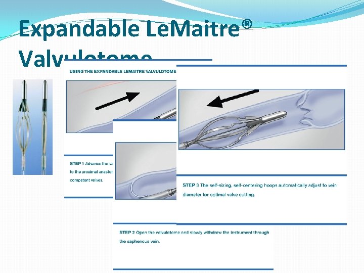 Expandable Le. Maitre® Valvulotome 