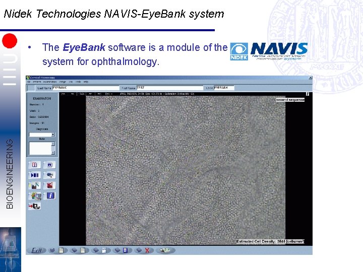 Nidek Technologies NAVIS-Eye. Bank system BIOENGINEERING • The Eye. Bank software is a module