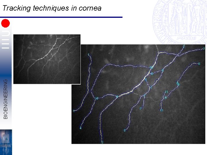 BIOENGINEERING Tracking techniques in cornea 