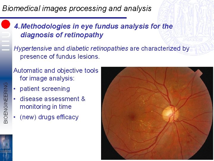 Biomedical images processing and analysis 4. Methodologies in eye fundus analysis for the diagnosis