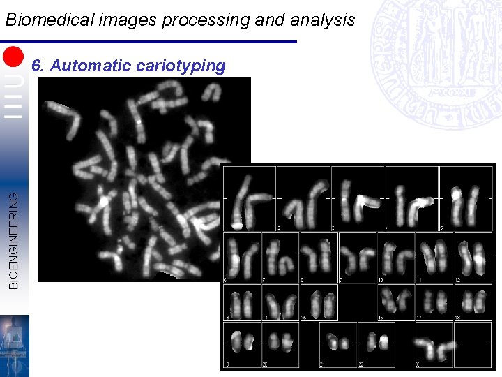 Biomedical images processing and analysis BIOENGINEERING 6. Automatic cariotyping 