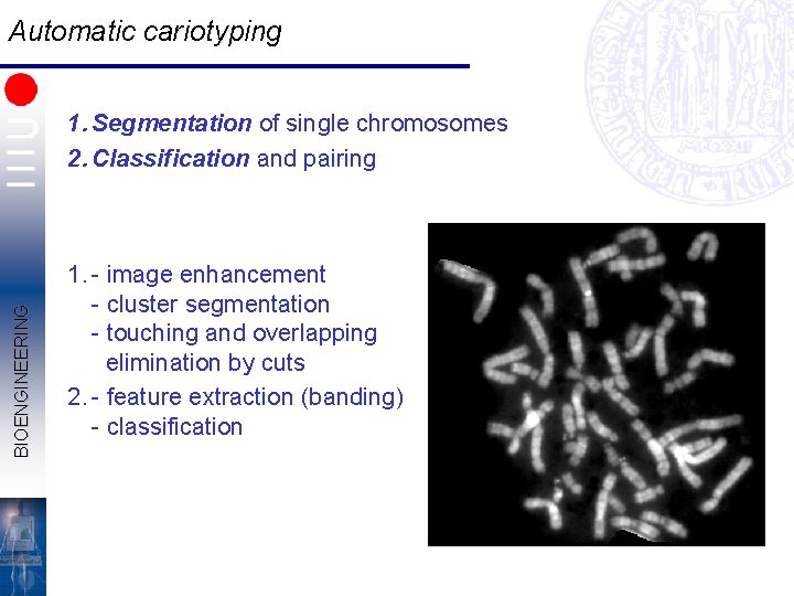 Automatic cariotyping BIOENGINEERING 1. Segmentation of single chromosomes 2. Classification and pairing 1. -