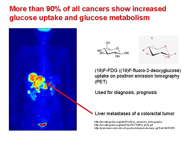 More than 90% of all cancers show increased glucose uptake and glucose metabolism (18)F-FDG