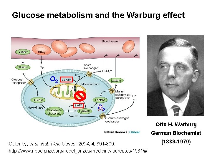 Glucose metabolism and the Warburg effect – Upregulated aerobic glycolysis and lactate production even
