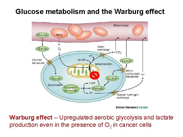 Glucose metabolism and the Warburg effect – Upregulated aerobic glycolysis and lactate production even