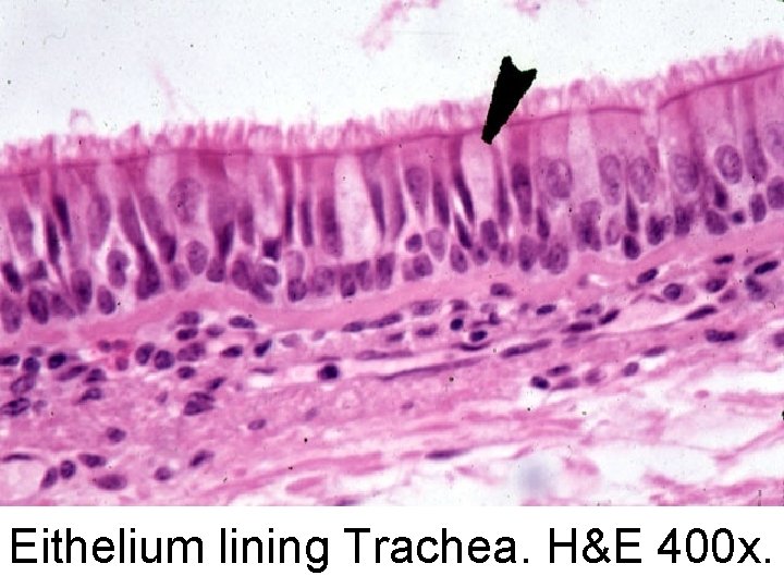 Eithelium lining Trachea. H&E 400 x. 