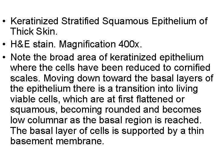  • Keratinized Stratified Squamous Epithelium of Thick Skin. • H&E stain. Magnification 400