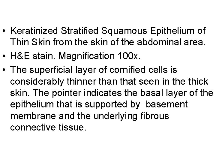  • Keratinized Stratified Squamous Epithelium of Thin Skin from the skin of the