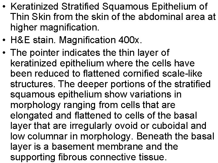  • Keratinized Stratified Squamous Epithelium of Thin Skin from the skin of the
