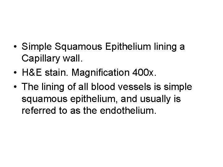  • Simple Squamous Epithelium lining a Capillary wall. • H&E stain. Magnification 400