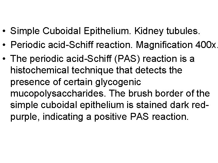  • Simple Cuboidal Epithelium. Kidney tubules. • Periodic acid-Schiff reaction. Magnification 400 x.