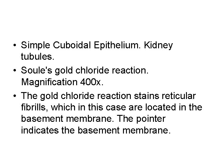 • Simple Cuboidal Epithelium. Kidney tubules. • Soule's gold chloride reaction. Magnification 400