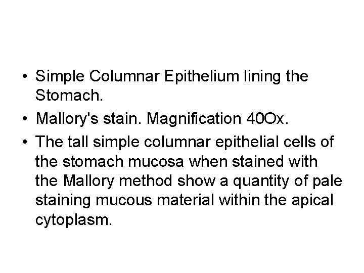  • Simple Columnar Epithelium lining the Stomach. • Mallory's stain. Magnification 40 Ox.