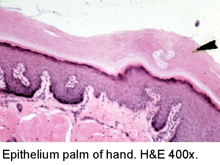 Epithelium palm of hand. H&E 400 x. 