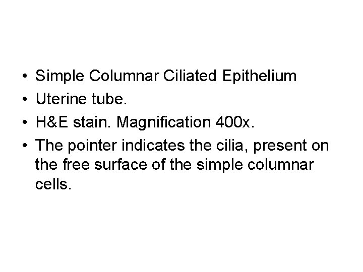  • • Simple Columnar Ciliated Epithelium Uterine tube. H&E stain. Magnification 400 x.