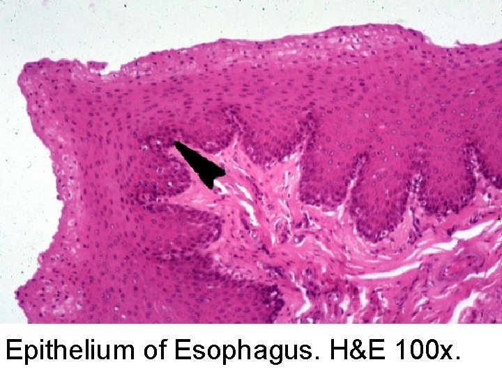 Epithelium of Esophagus. H&E 100 x. 