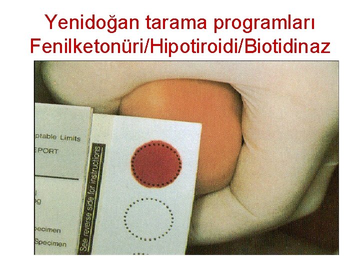 Yenidoğan tarama programları Fenilketonüri/Hipotiroidi/Biotidinaz 9 