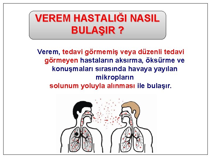 VEREM HASTALIĞI NASIL BULAŞIR ? Verem, tedavi görmemiş veya düzenli tedavi görmeyen hastaların aksırma,