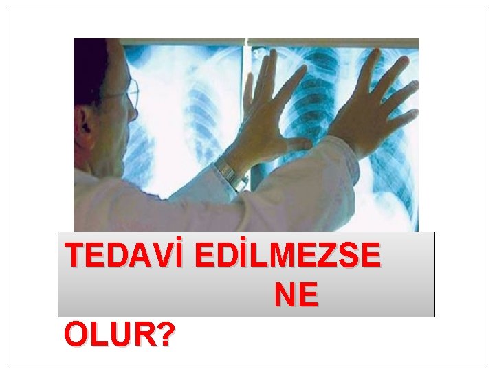 TEDAVİ EDİLMEZSE NE OLUR? 