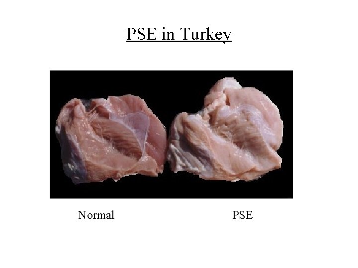 PSE in Turkey Normal PSE 