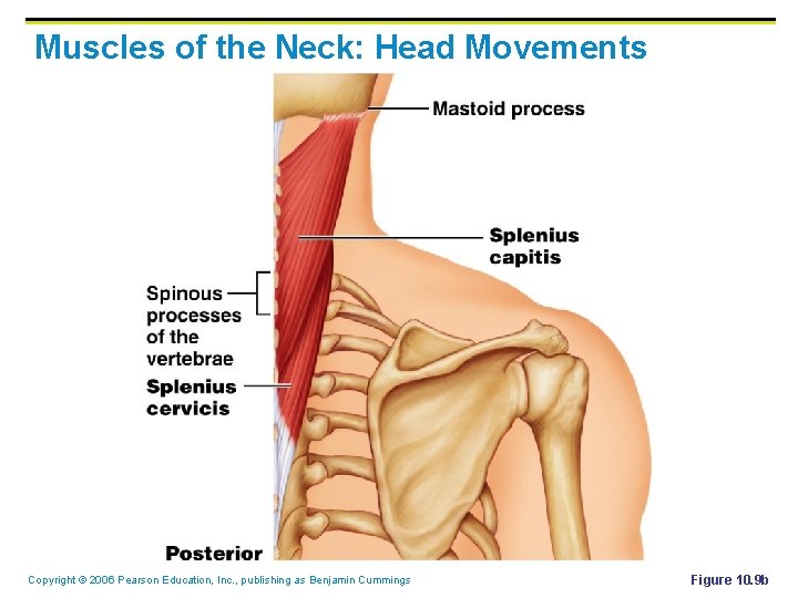 Muscles of the Neck: Head Movements Copyright © 2006 Pearson Education, Inc. , publishing