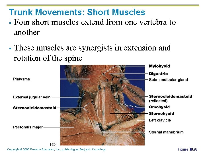 Trunk Movements: Short Muscles § Four short muscles extend from one vertebra to another