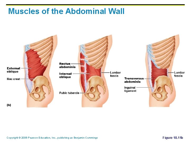Muscles of the Abdominal Wall Copyright © 2006 Pearson Education, Inc. , publishing as