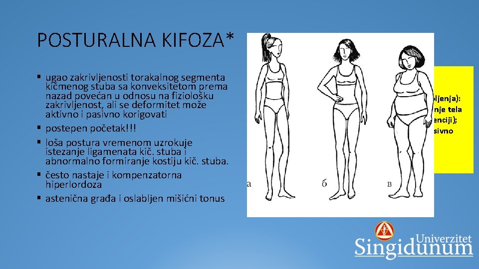 POSTURALNA KIFOZA* § ugao zakrivljenosti torakalnog segmenta kičmenog stuba sa konveksitetom prema nazad povećan