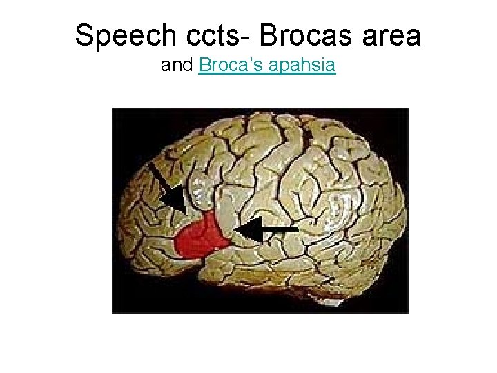 Speech ccts- Brocas area and Broca’s apahsia 