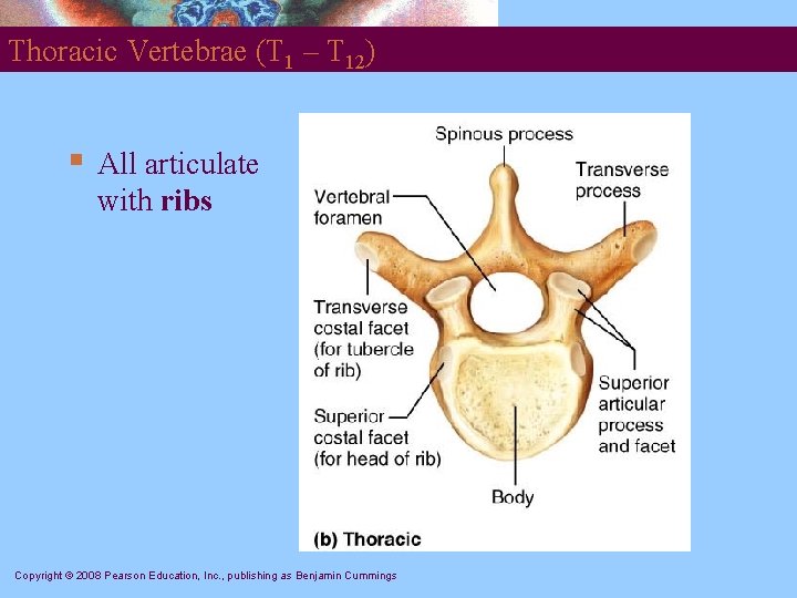 Thoracic Vertebrae (T 1 – T 12) § All articulate with ribs Copyright ©