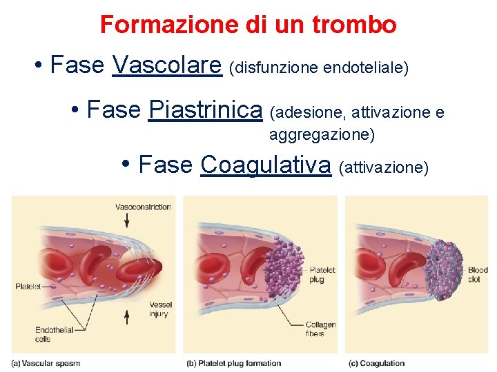 Formazione di un trombo • Fase Vascolare (disfunzione endoteliale) • Fase Piastrinica (adesione, attivazione