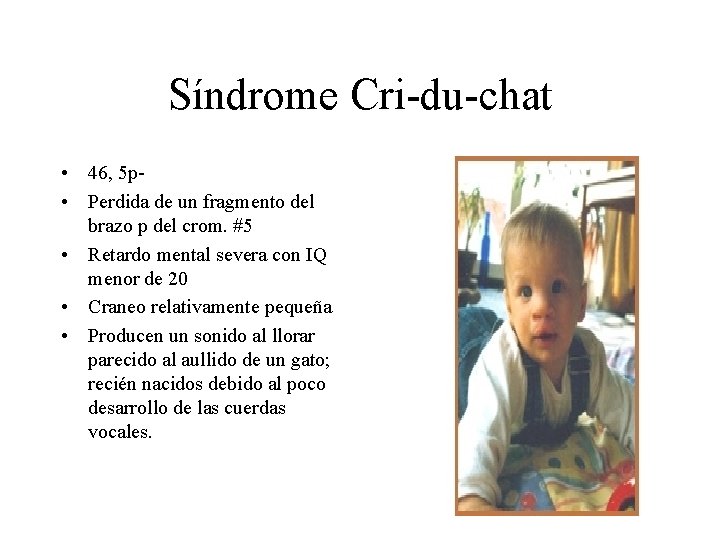 Síndrome Cri-du-chat • 46, 5 p • Perdida de un fragmento del brazo p